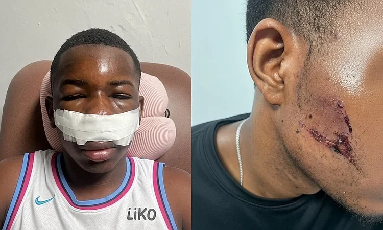 Impactante accidente en Punta Cana: conductor embiste buggy y huye dejando dos heridos