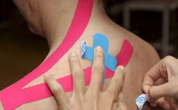 Cintas de colores para el dolor: evidencia muy baja y alivio temporal, según BMJ