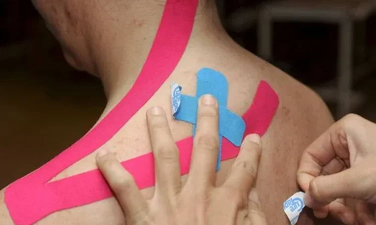 Cintas de colores para el dolor: evidencia muy baja y alivio temporal, según BMJ