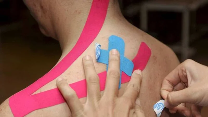 Cintas de colores para el dolor: evidencia muy baja y alivio temporal, según BMJ