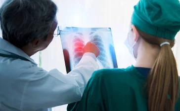 El cáncer de pulmón y la detección precoz: el debate que marca la agenda sanitaria mundial