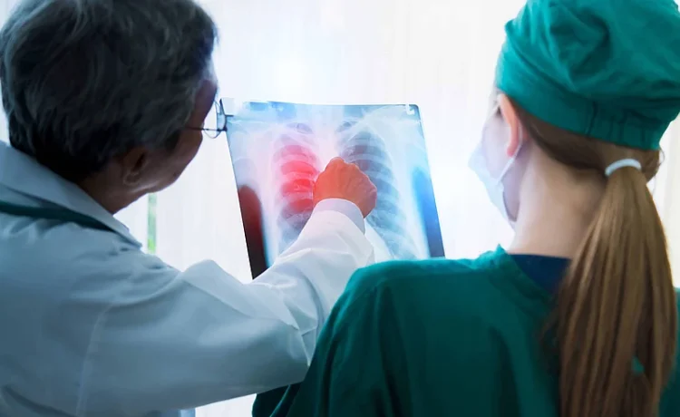 El cáncer de pulmón y la detección precoz: el debate que marca la agenda sanitaria mundial