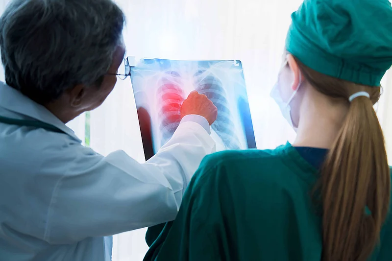 El cáncer de pulmón y la detección precoz: el debate que marca la agenda sanitaria mundial