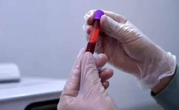 Sangre capilar: el nuevo aliado para multiplicar los controles antidopaje en el deporte global