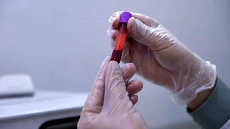 Sangre capilar: el nuevo aliado para multiplicar los controles antidopaje en el deporte global